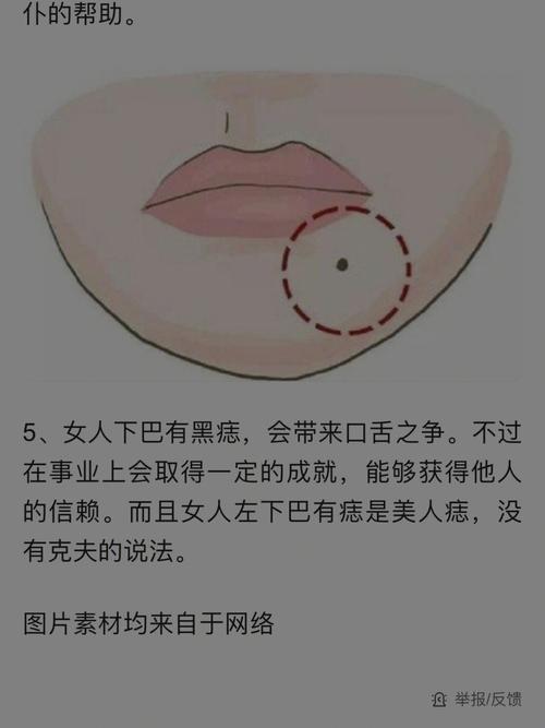 男人嘴角的美人痣是富贵痣吗