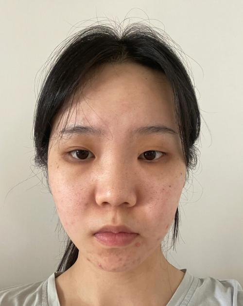 没有卧蚕的女人的命运