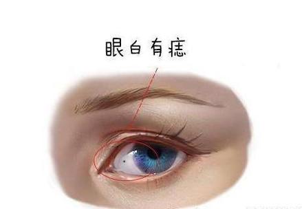 女人眼白多有什么说法