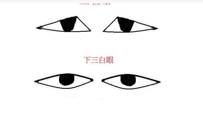 眼睛看相:什么叫三白眼