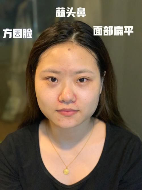 鼻子扁平的人好不好
