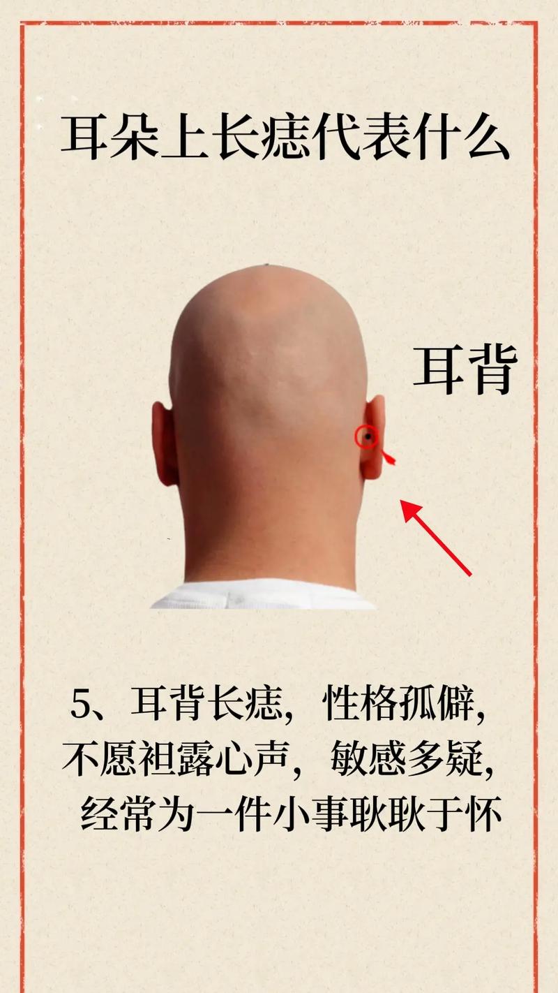 耳朵边上有痣预示着什么
