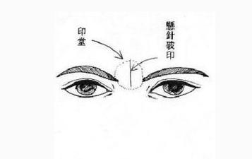 印堂有竖纹的人是不是很容易生气