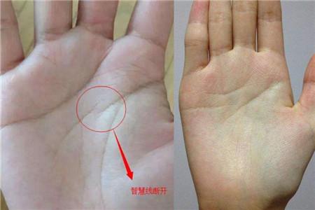 手相智慧线断开分了三段,需警惕头部疾病!