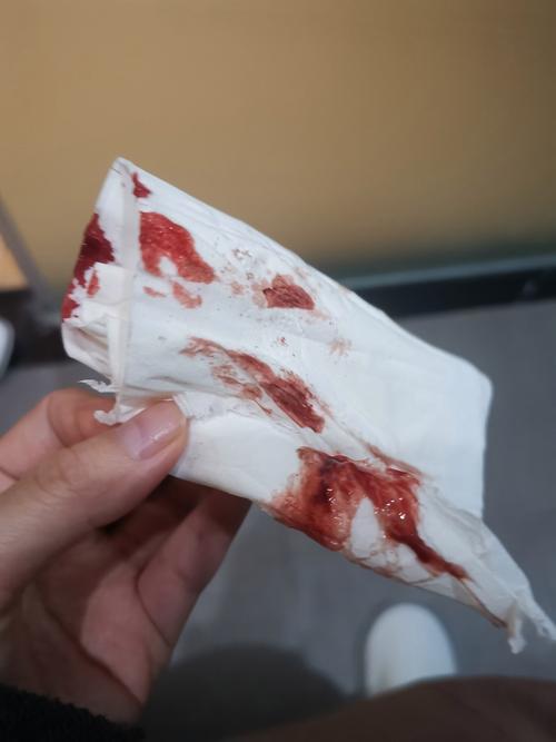 梦见别人流出鲜红的血
