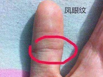 假凤尾纹是怎样的