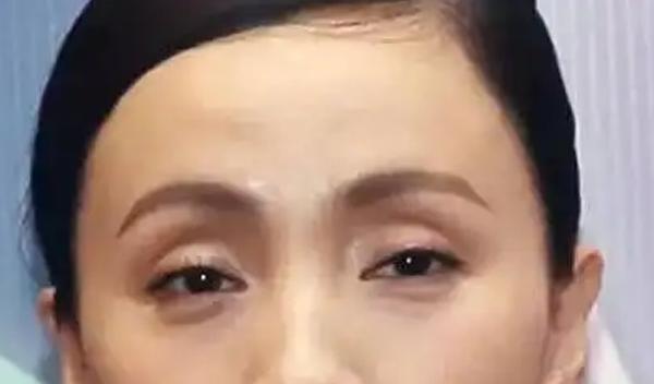 女人穷相特征眼球深陷