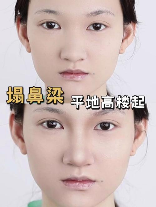 鼻相中的山根是什么意思？