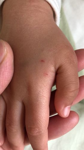 梦见被猴子抓伤是什么意思