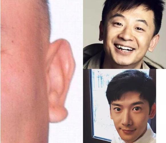 耳垂大而下垂的人非常注重情谊吗