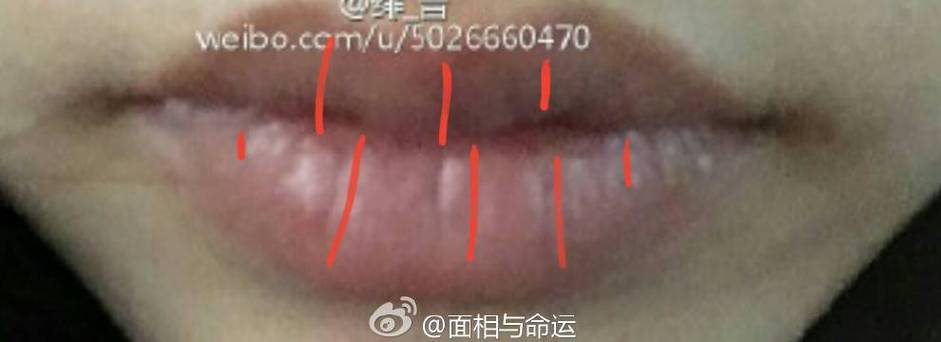 下嘴唇有竖纹面相分析