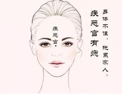 疾厄宫有痣的女人容易生病吗