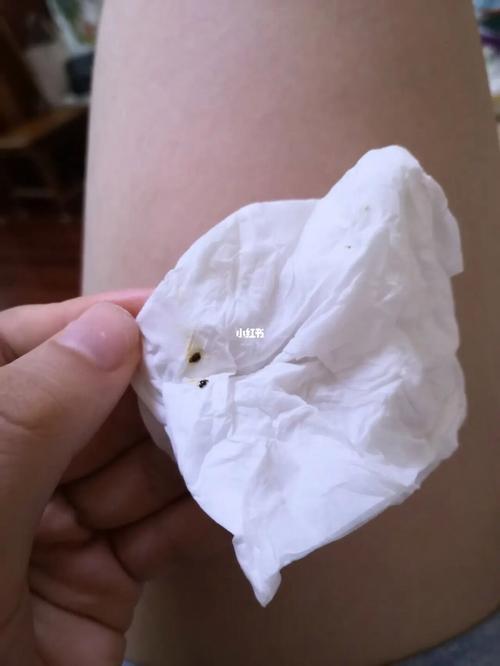 梦见芝麻生虫