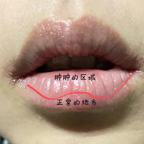 口角不张是清贫破败的面相吗