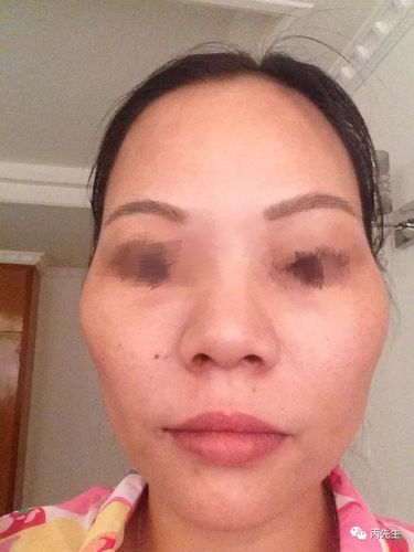 太阳凹陷颧骨高女人面相好吗