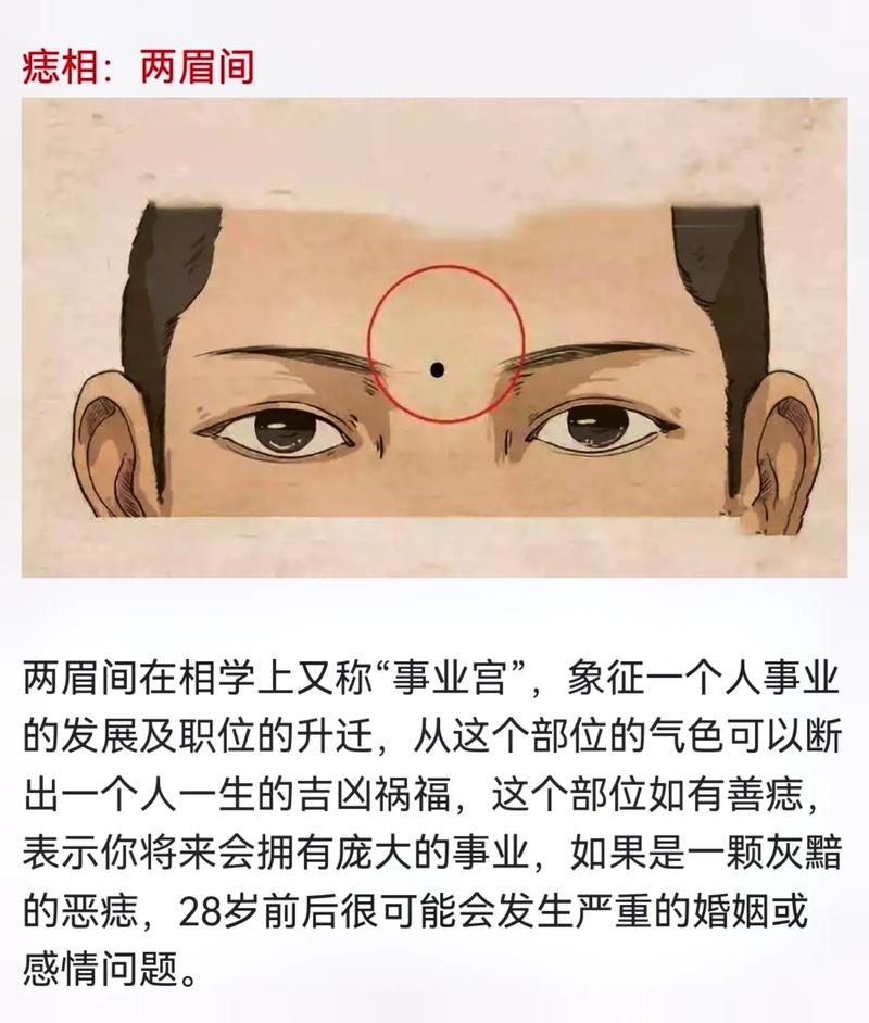 面部痣可以随便点掉吗 盲目点痣的危害