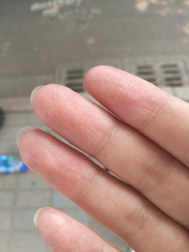 十个手指肚上都有横纹