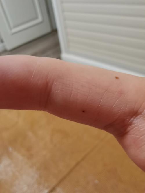 右手食指第一关节有痣好不好