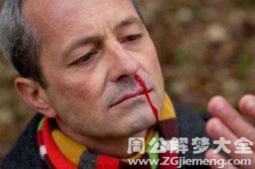 梦见父亲流鼻血