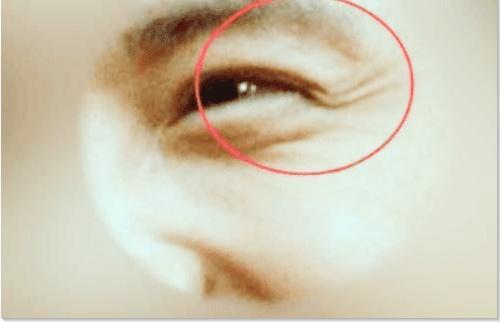 男人眼下有桃花纹