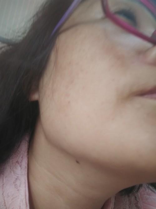 下巴底下的抬头痣