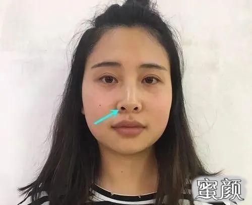 女人朝天鼻命苦是不是真的