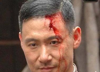 梦见头流血是什么预兆