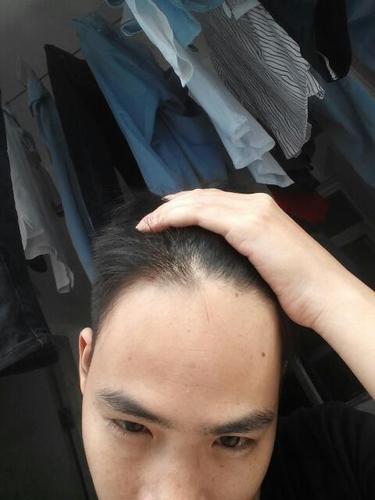 前额头有旋涡的命相