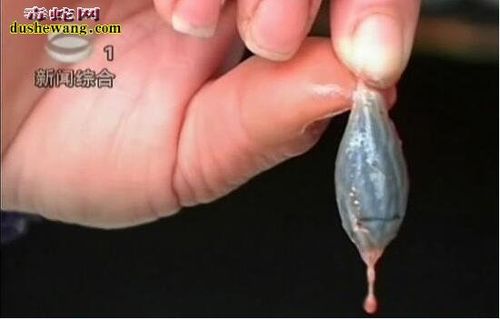 梦见杀蛇吃蛇胆暗示什么?