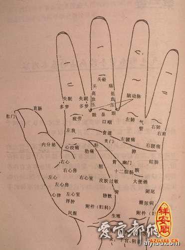 掌心痣代表了什么