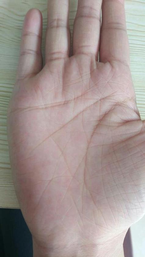 感情线上有向上的竖纹