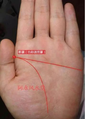 双手假断掌的男人的命运
