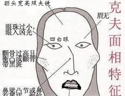 揭秘喜欢告状的人面相特征