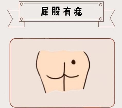 屁股下巴上有痣是福还是祸呢