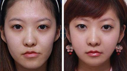 印堂八字纹的女人面相怎么样