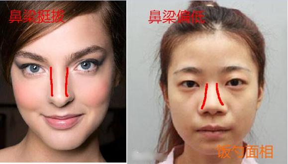 偏凹鼻面相特征