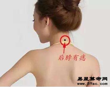 脖子后面有痣代表什么意思?据说是靠山