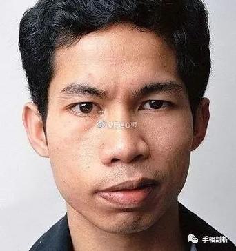 嘴巴歪的面相,天生嘴歪的男人面相