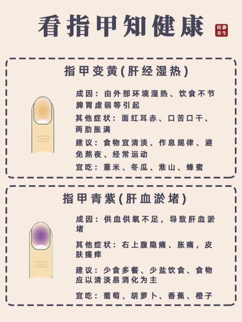 详解:指甲纹理看运势