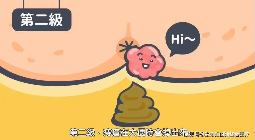 女人梦见厕所里好多屎