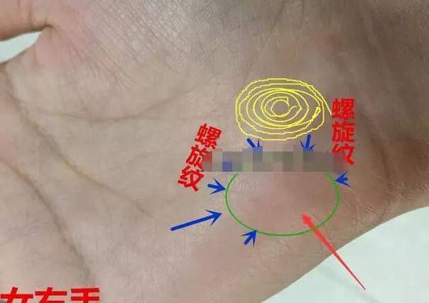男人0个螺纹是什么命