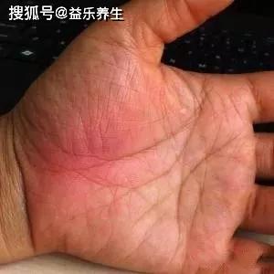手掌上这块肉,一看就知道你身体好不好!