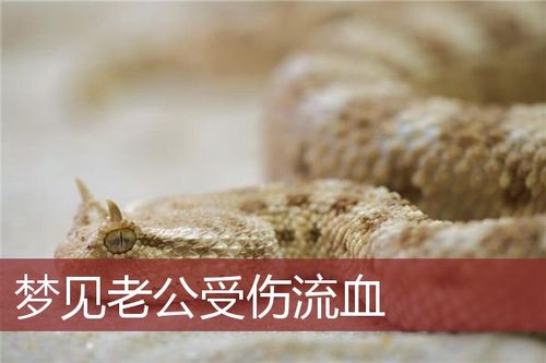 梦见老公摔倒流血