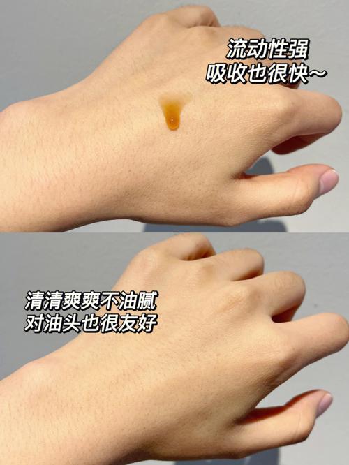 做梦梦见自己秃顶有什么说法?