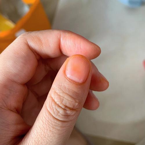 梦见红色的虾 梦见红色的虾跑来跑去