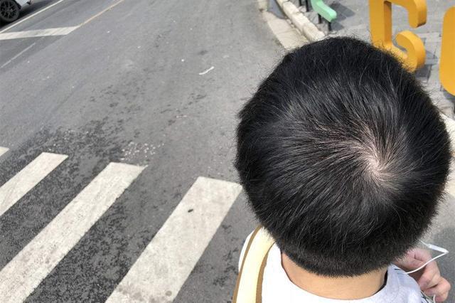 女人头顶双旋有什么说法?头顶双旋命运怎么样?
