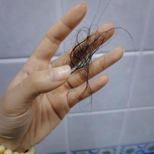 女人梦见头发掉光了,昨晚梦见自己的头发掉光了有何征兆求解