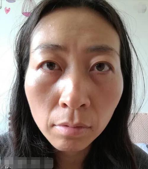 颧骨高的女人有什么不好