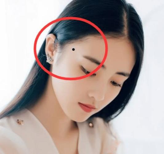 细数脸上吉痣 有这几种痣 发财不是梦