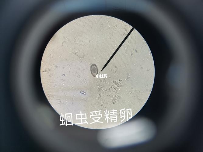 梦见各种虫卵好吗